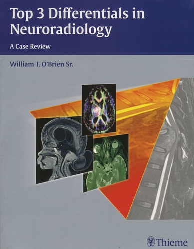 William-T O'Brien - Top 3 Differentials in Neuroradiology - A Case Review.
