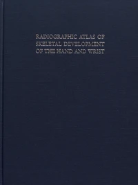 Radiographic Atlas of Skeletal Development of the Hand and Wrist