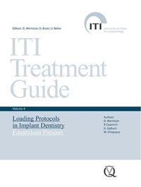 Loading protocols in implant dentistery