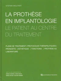 La prothèse en implantologie