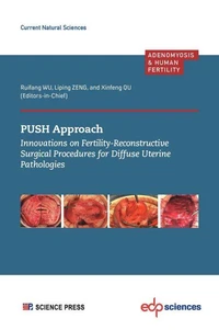 PUSH Approach