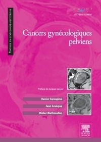 Xavier Carcopino et Jean Lévêque - Cancers gynécologiques pelviens.