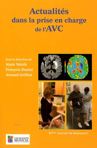 Actualités dans la prise en charge de l'AVC