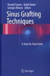 Sinus Grafting Techniques