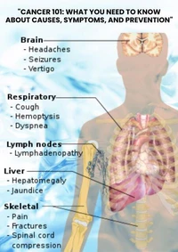 "Cancer 101: What You Need to Know About Causes, Symptoms, and Prevention"