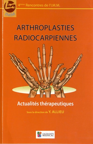 Yves Allieu - Arthroplasties radiocarpiennes.