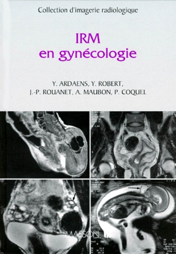 Yves Ardaens et Y Robert - IRM en gynécologie.