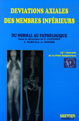 Yves Catonné et E Sari-Ali - Déviations axiales des membres inférieurs - Du normal au pathologique.