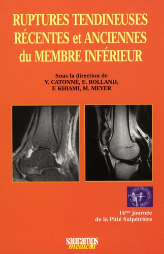 Yves Catonné et E. Rolland - Ruptures tendineuses récentes et anciennes du membre inférieur.