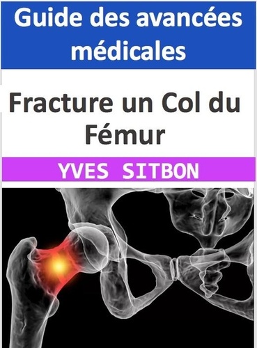  YVES SITBON - Fracture un Col du Fémur : Guide des avancées médicales.