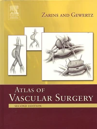 Atlas of Vascular Surgery