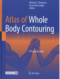 Atlas of Whole Body Contouring