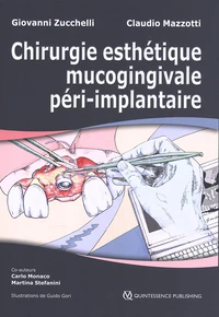 Chirurgie esthétique mucogingivale péri-implantaire