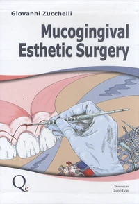 Mucogingival Esthetic Surgery